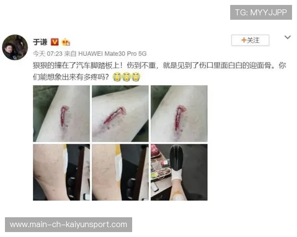 运动员深夜晒伤腿照：粉丝心疼